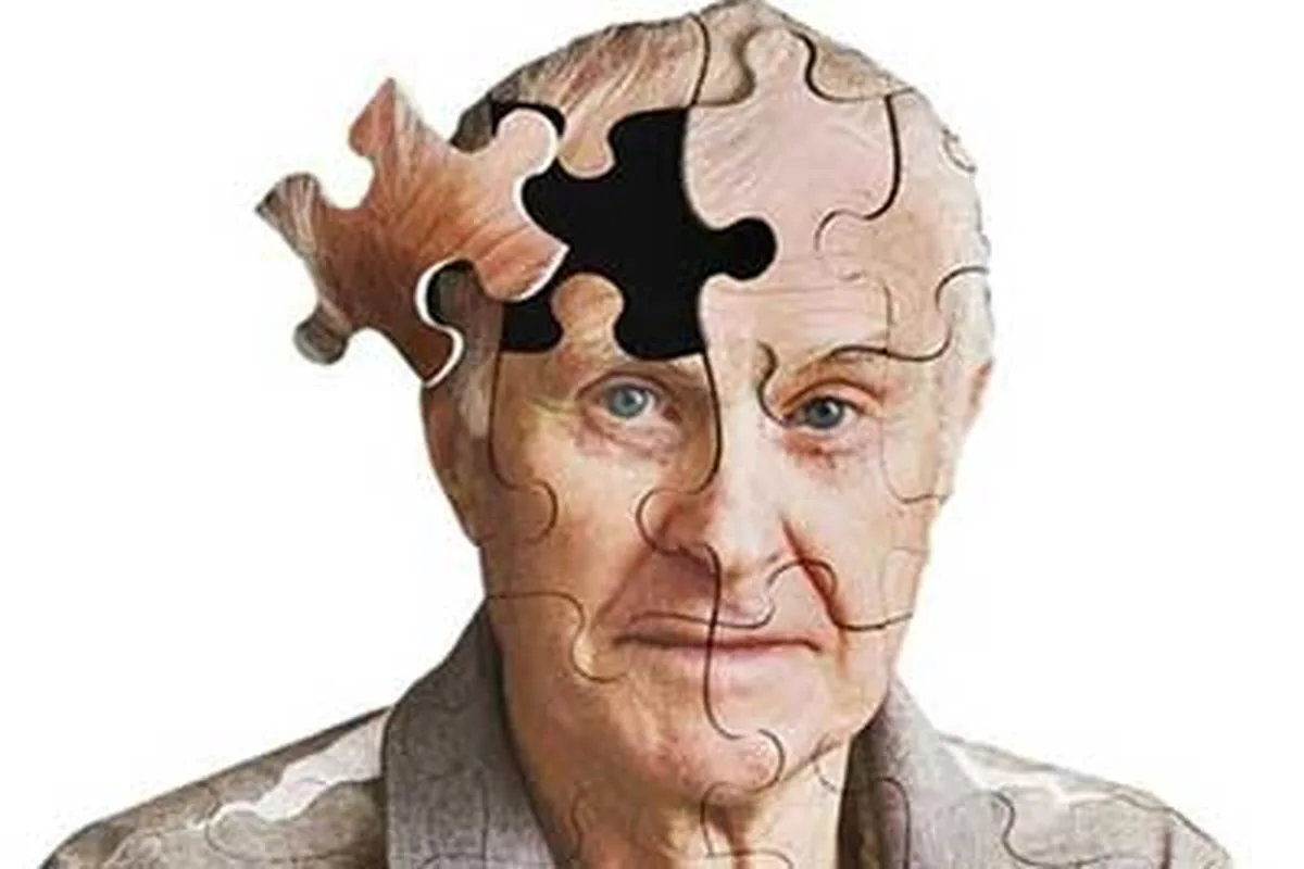 آلزایمر برای پیرها و جوانها / راههای کاهش ابتلا به آلزایمر