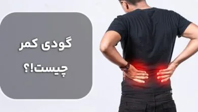 توصیههای مهم به افرادی که گودی کمر دارند