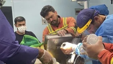 چرخ گوشت به طور عجیبی انگشتان کارگر را بلعید