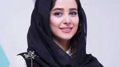 چهره جدید خانم بازیگر بعد از عمل زیبایی سوژه شد +عکس