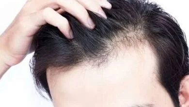 کمبود این ویتامینها سبب ریزش مو میشود