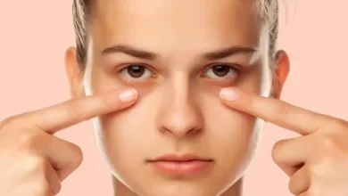 چند راهکار فوری برای رفع پف زیر چشم