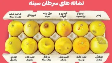 شایع‌ترین علائم سرطان سینه