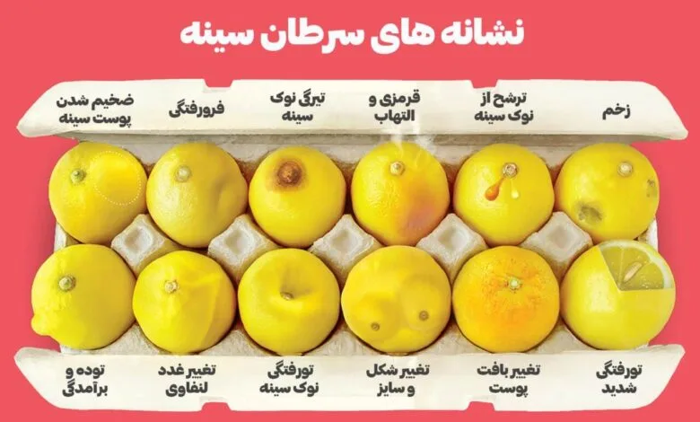 شایع‌ترین علائم سرطان سینه