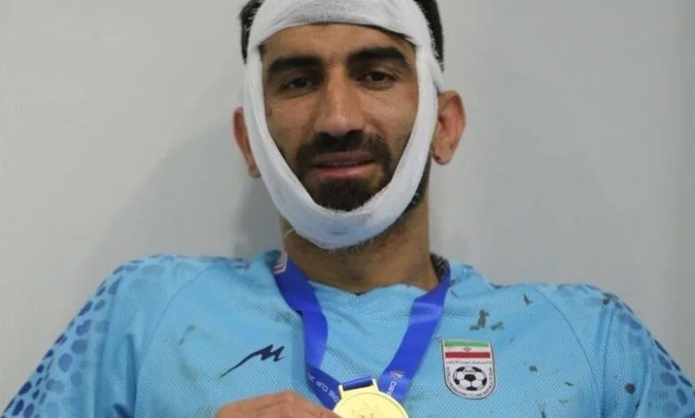 فک بیرانوند دچار شکستگی شد
