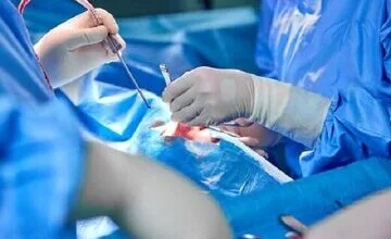 این جراحی برای اولین بار در ایران انجام شد