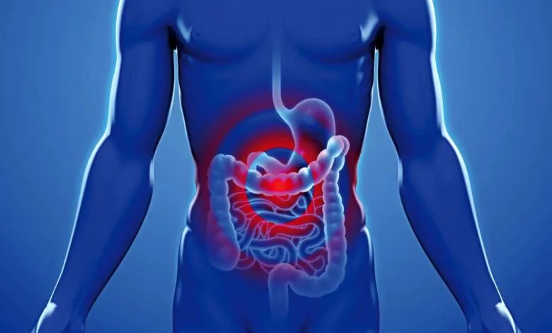علائم اولیه و دلیل ابتلا به سرطان روده بزرگ