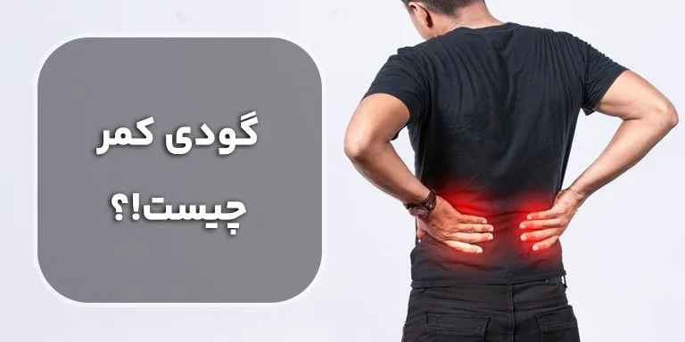 توصیه‌های مهم به افرادی که گودی کمر دارند