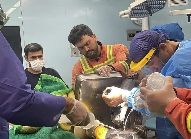 چرخ گوشت به طور عجیبی انگشتان کارگر را بلعید