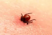 هشدار جدی درباره تب کریمه کنگو