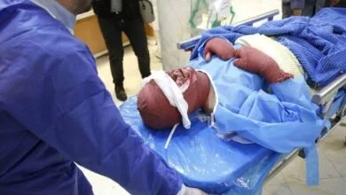 ۵ نکته مهم هنگام وقوع حادثه در چهارشنبه سوری